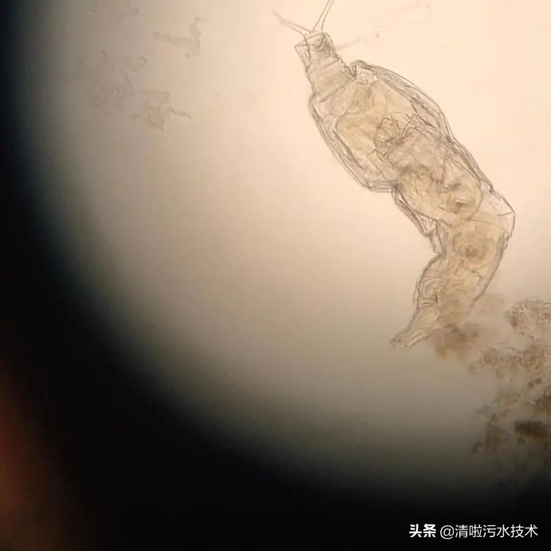 微生物镜检用什么试剂,微生物镜检表