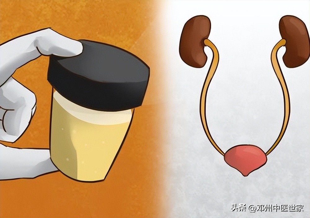 治慢性肾炎蛋白尿的老中医,经方治疗肾炎蛋白尿