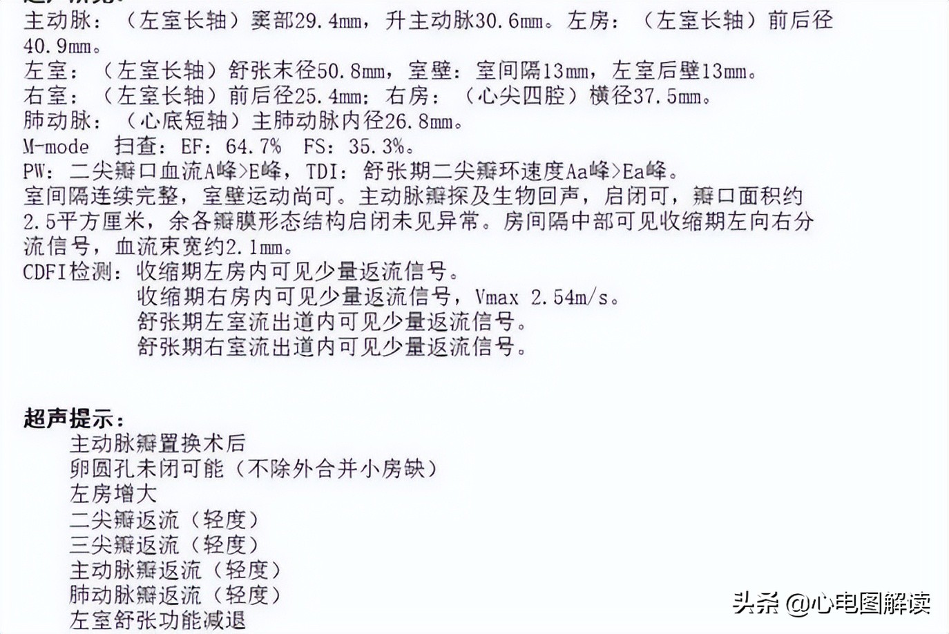 t型波异常什么意思,t波改变类型