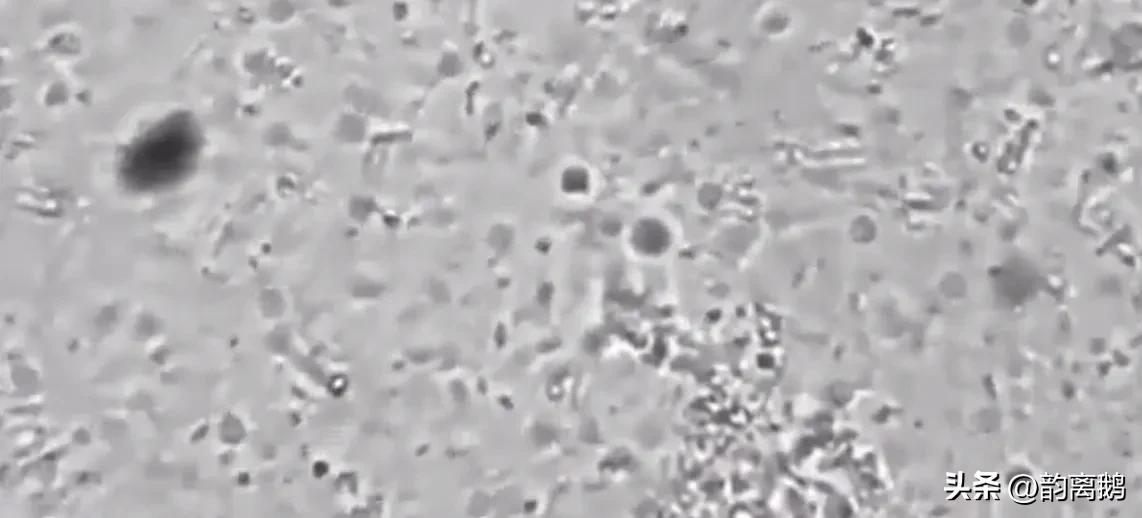 为什么抠了肚脐眼肚子会痛,为什么抠了肚脐会拉肚子