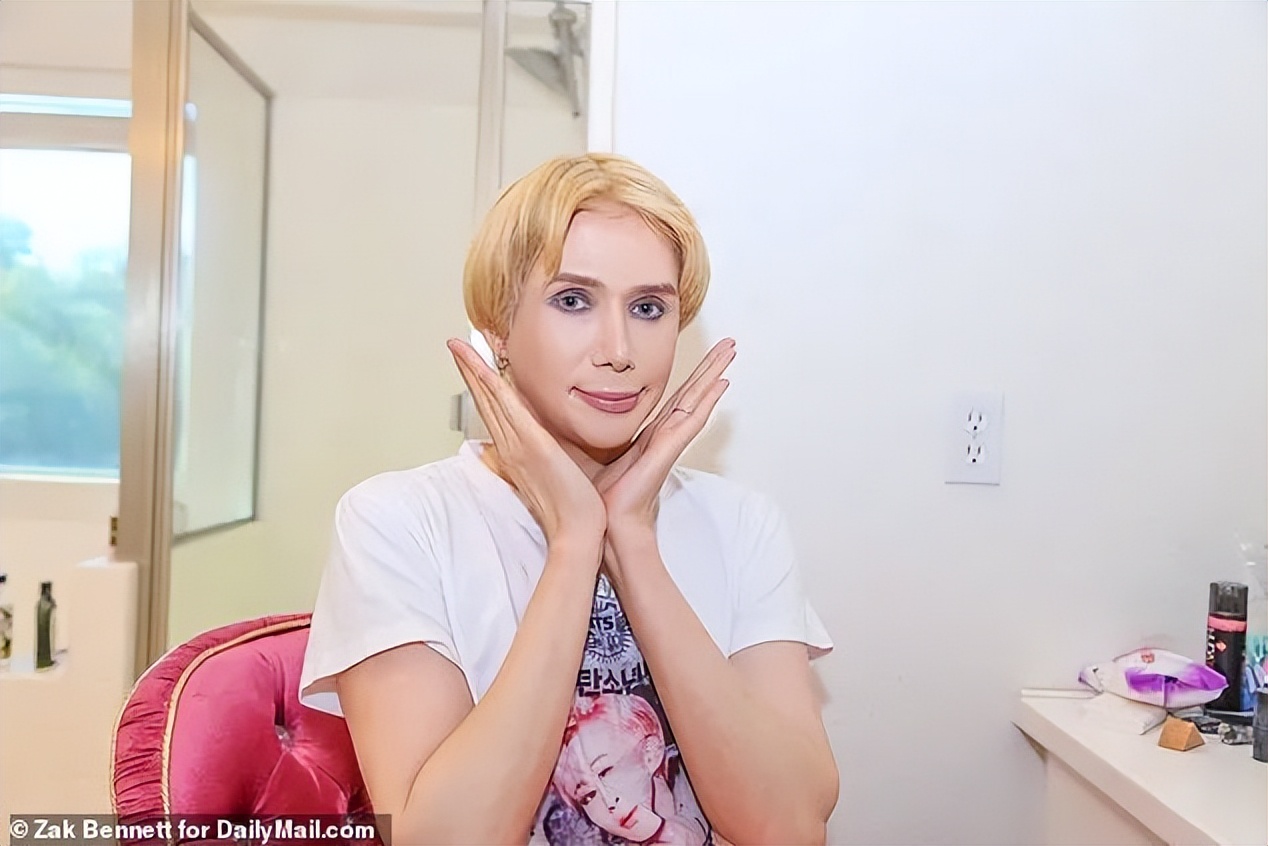 疯狂整容的网红,美国白人网红整成韩国人