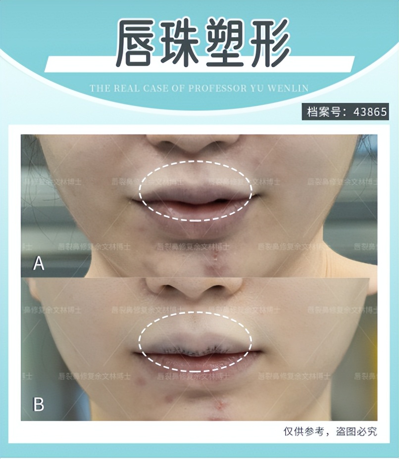 公认最好看的四种嘴唇,什么样的嘴唇最好看呢