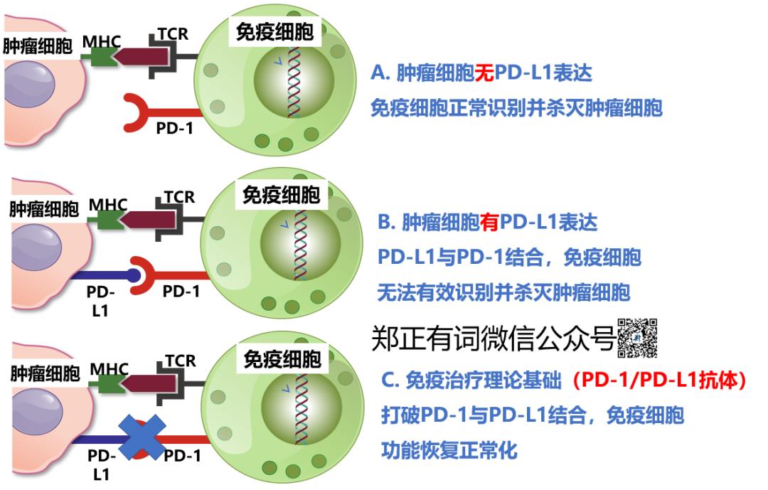 食管癌治疗最新突破,最新食管癌治愈率