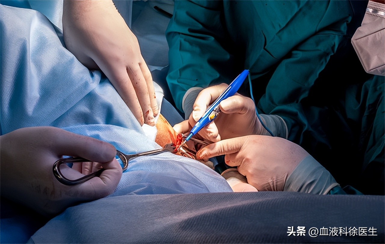 肛瘘手术不彻底医生有责任吗,肛瘘不想手术