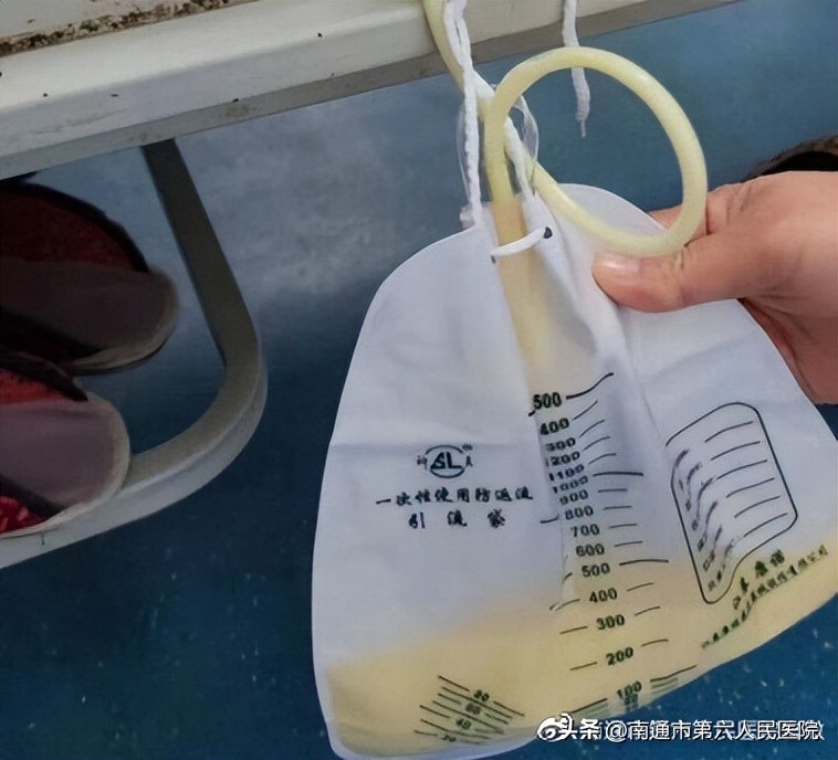 老人有痰咳不出来无意识,八旬大爷呼吸困难声嘶咳血