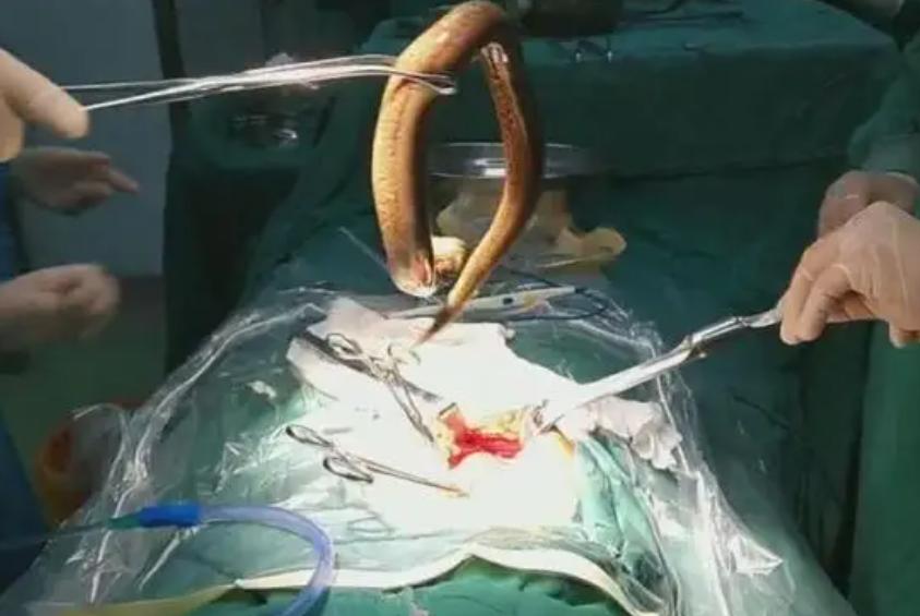 蛇吃毒蛇为什么不会中毒,蛇吃生肉为什么不会得病