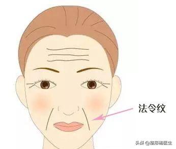 有法令纹特显老教你几招抚平细纹,法令纹这么显老得如何搞定