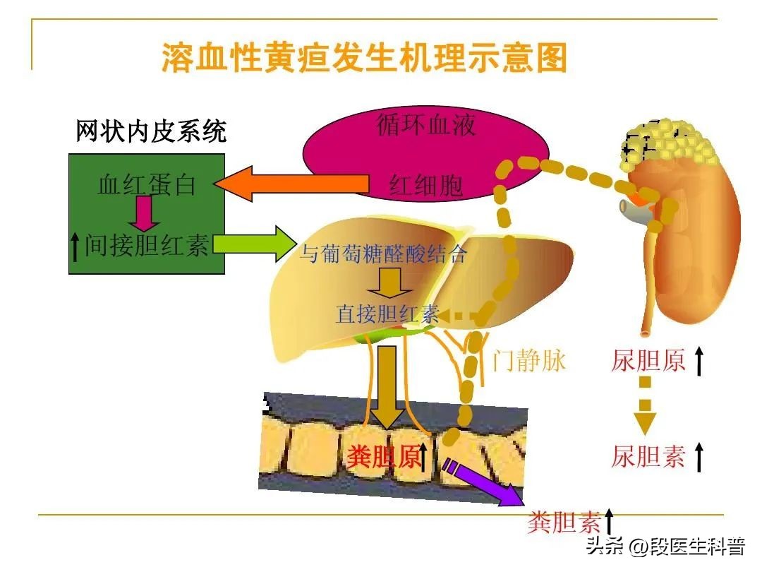 黄疸都有哪些明显症状,黄疸有哪些典型症状
