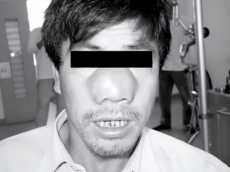 鼻息肉手术后要预防什么,怎样预防鼻窦炎和鼻息肉