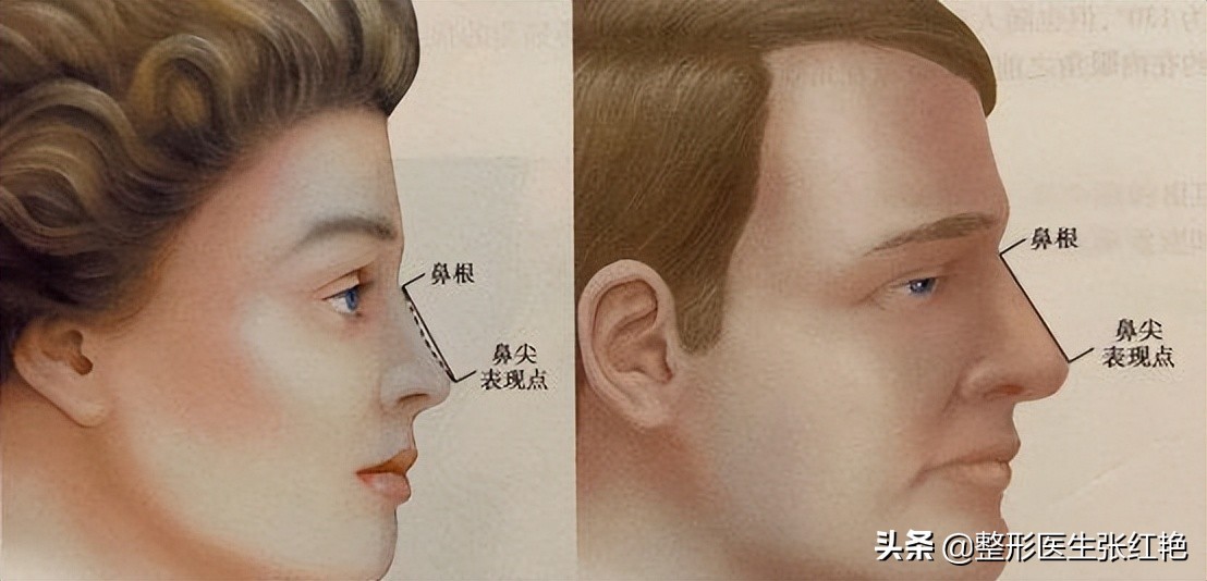 驼峰鼻的矫正八大处,河南驼峰鼻矫正大约费用是多少