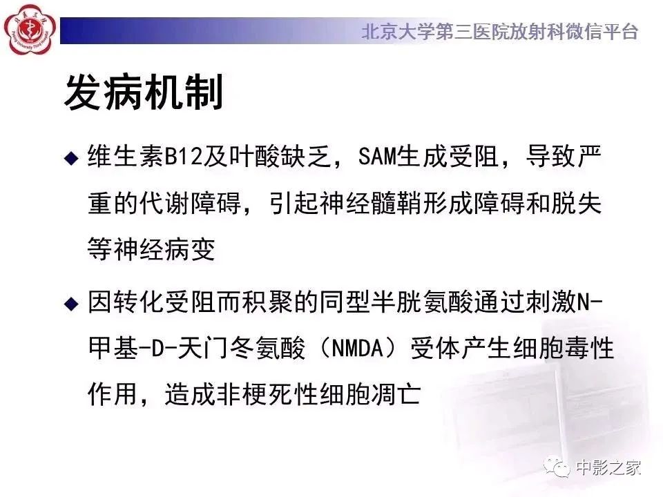 什么叫原发性胼胝体变性,原发性胼胝体变性治疗多少钱