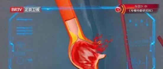 中国台湾演员猝死,知名女演员猝死去世