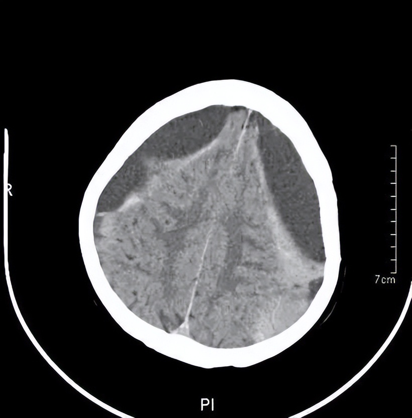 记忆门诊深圳,记忆门诊诊疗流程