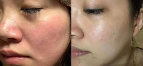 鏅哄閱掕偆鎶楄“淇姢闈㈣啘,鏅哄閱掕偆鎶楃毐淇姢闈㈣啘