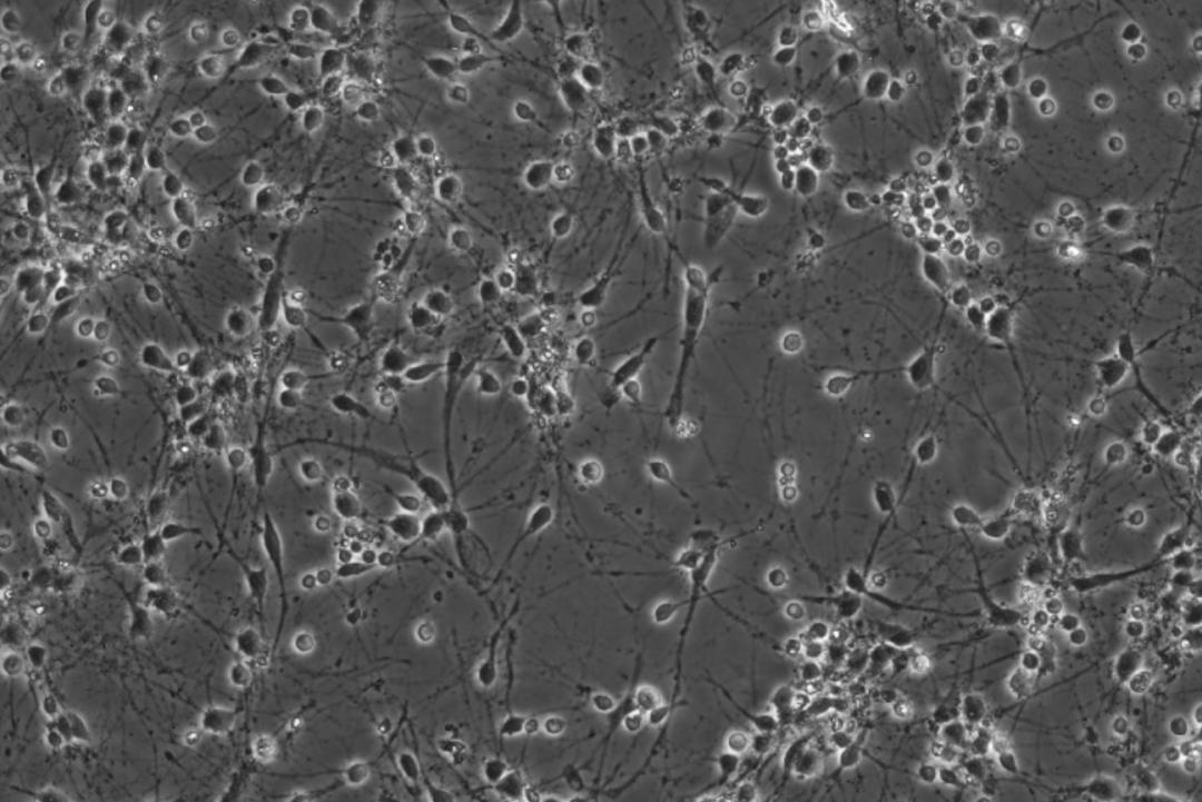 人类大脑为什么越来越厉害,你知道人类大脑的容量有多大