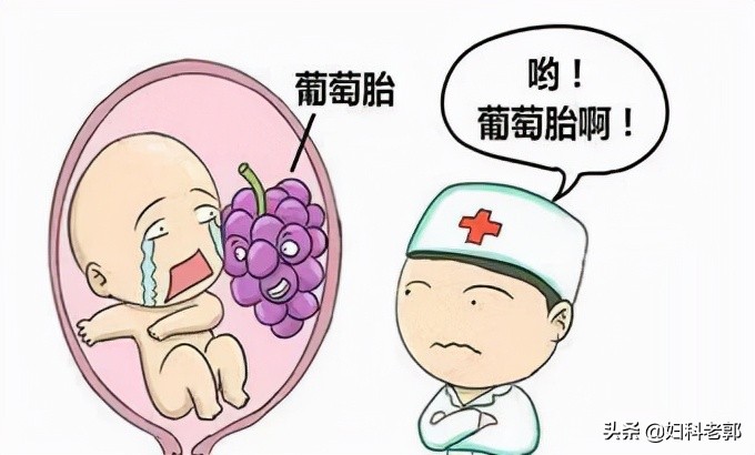 葡萄胎容易怀上怪胎吗,葡萄胎是不是怪胎