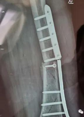 钢板为什么会无缘无故的断了,钢板一般情况下会不会断裂