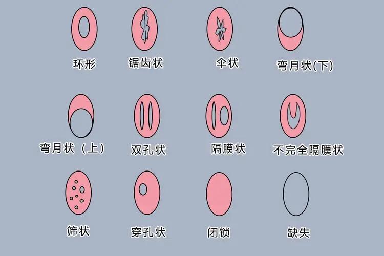 男女生理差别冷知识,男女生理冷知识科普