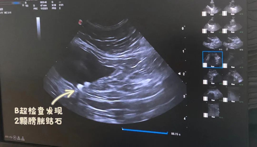 猫咪尿结石反复怎么解决,猫咪尿结石吃什么药消结石