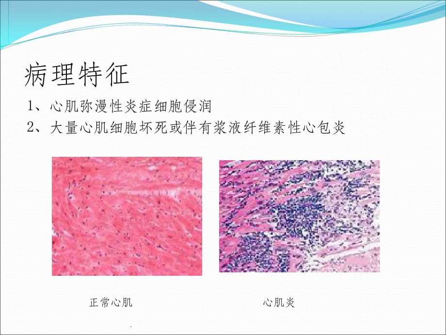 75岁以上老人反复发烧伴有咳嗽,75岁老人感冒咳嗽怎么办