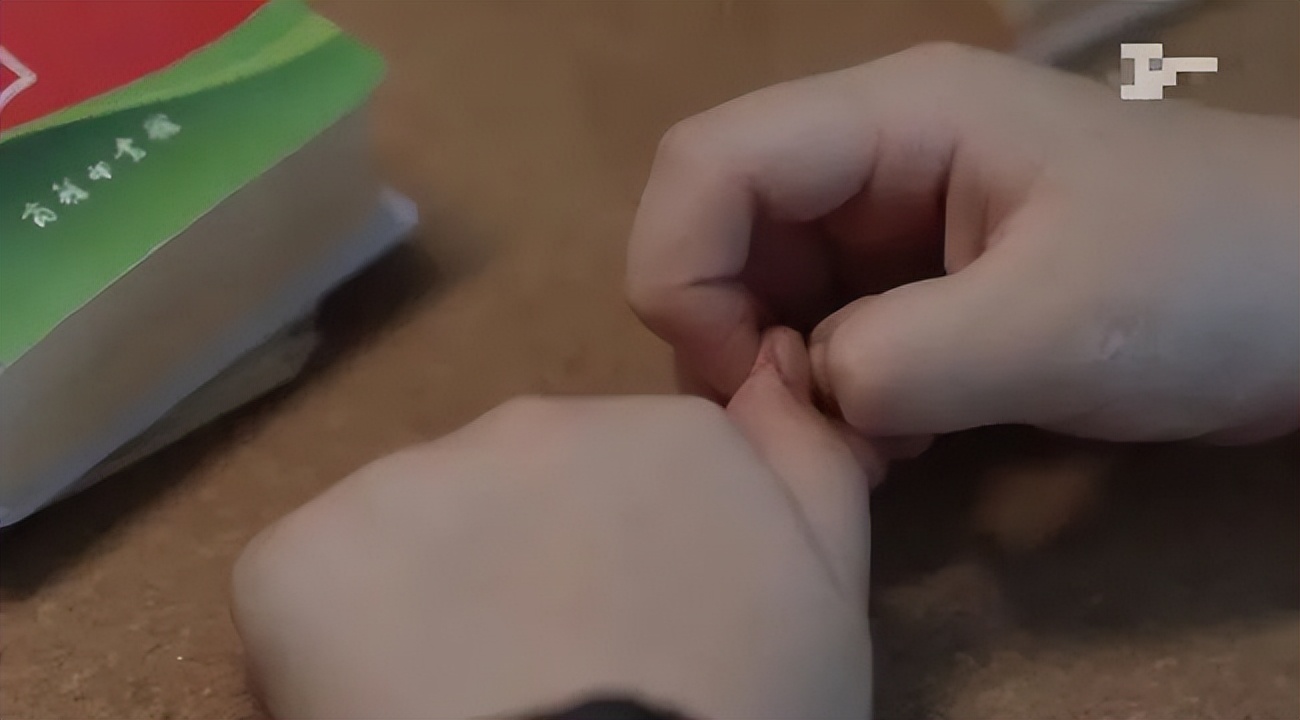 孩子总是抠手指缺什么吗,抠指甲是缺什么维生素