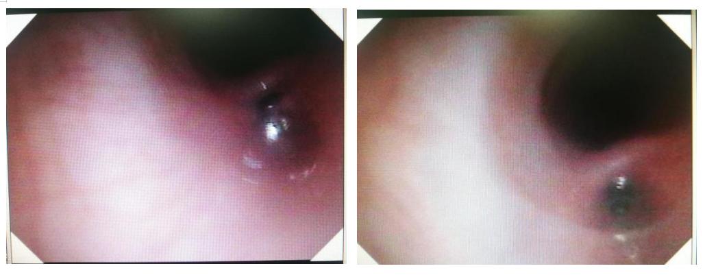 徐州市儿童医院呼吸二科,儿童呼吸介入科的设备