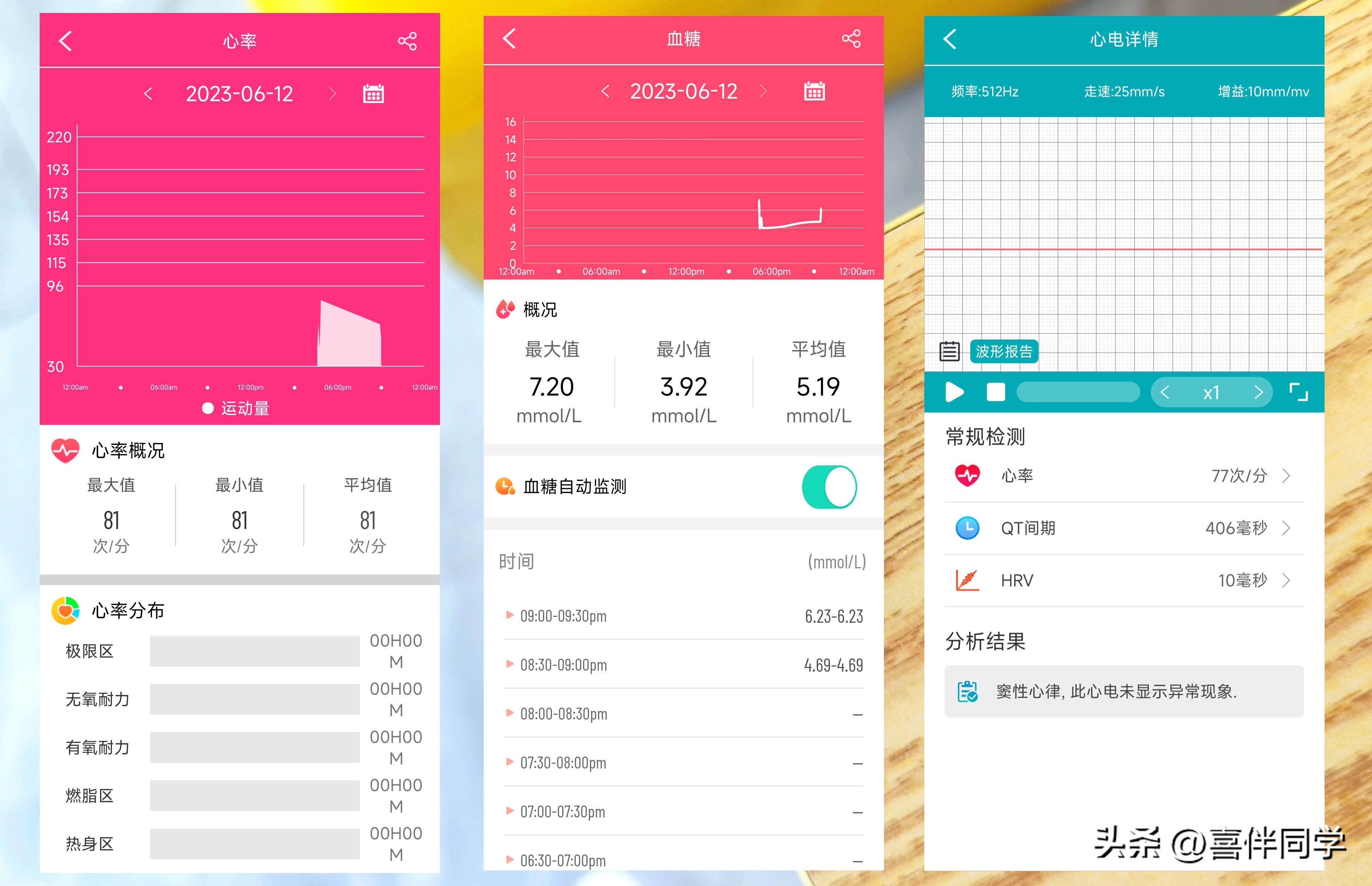 心电图血压手环测评,比较好能测血压的智能手环