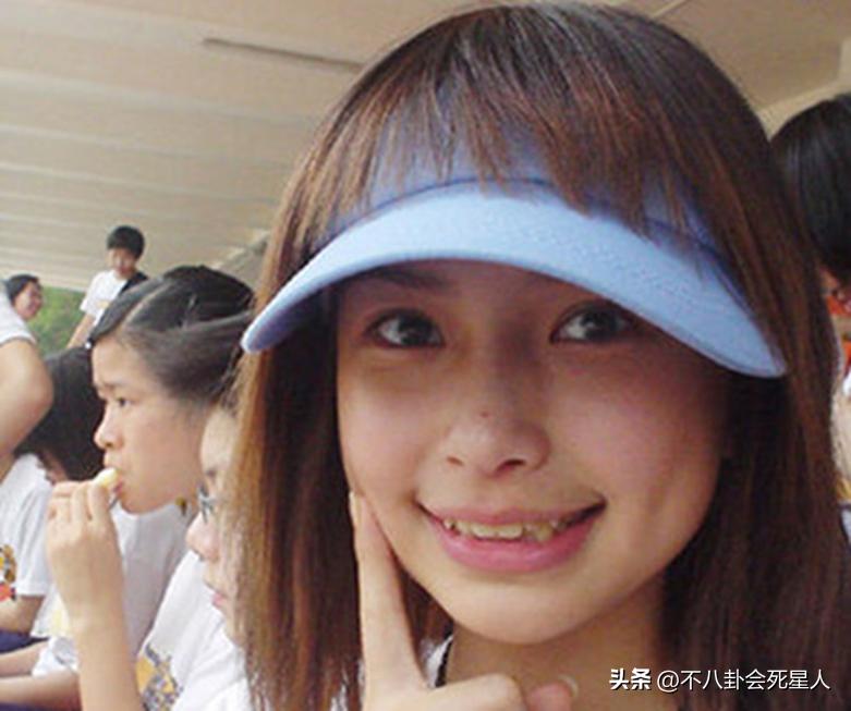 戴牙套是双刃剑：毛不易拯救一口烂牙，刘雯、肖战却变难看了