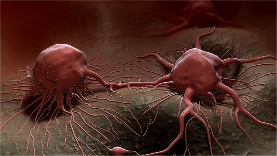 为什么手术成功术后人还是死了,手术成功为何病人还是死了