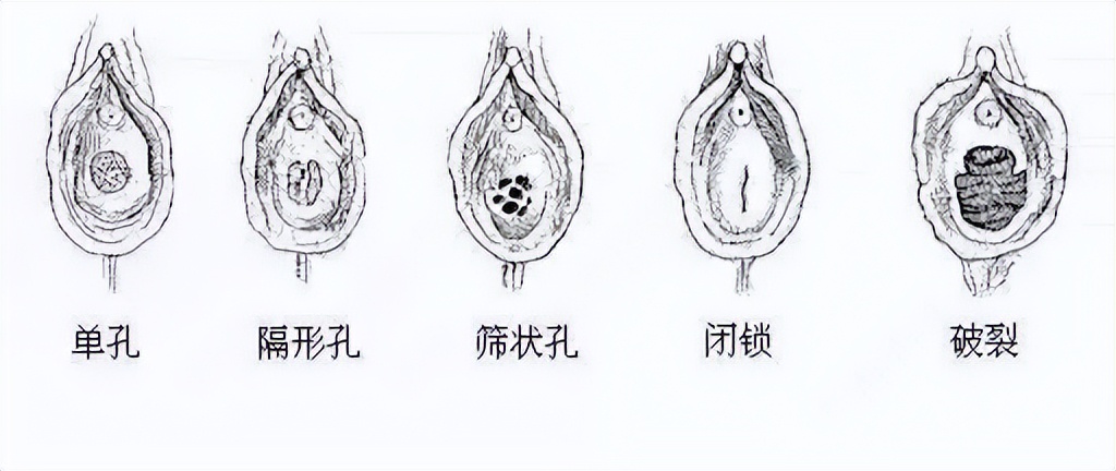 女孩第一次过*生活性**,并不是都会*体下**流血,请不要冤枉她们的贞洁