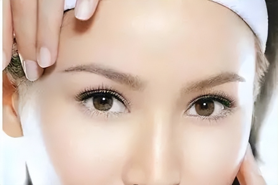 玻尿酸打额头的方法,玻尿酸打鼻子山根变宽真实案例