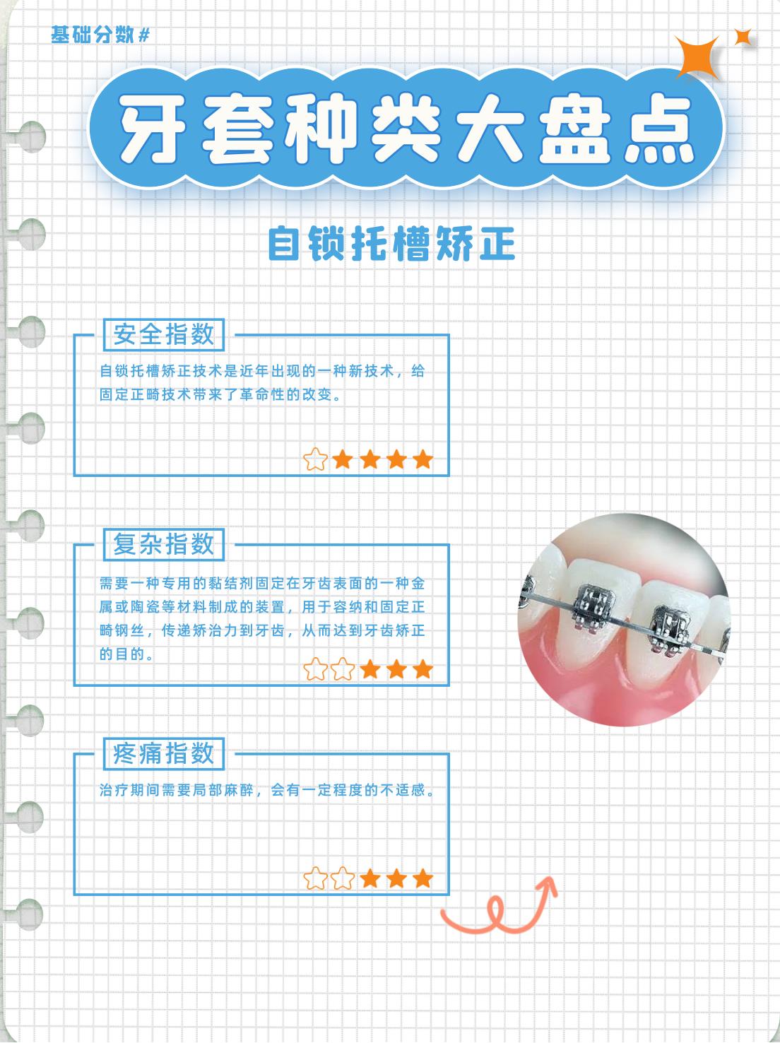 托槽隐形牙套全过程解析,正畸牙套普通托槽和自锁的区别