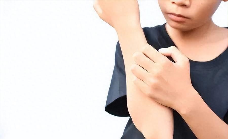 夏日宝宝皮肤红痒,宝宝脸干红痒起疙瘩怎么办