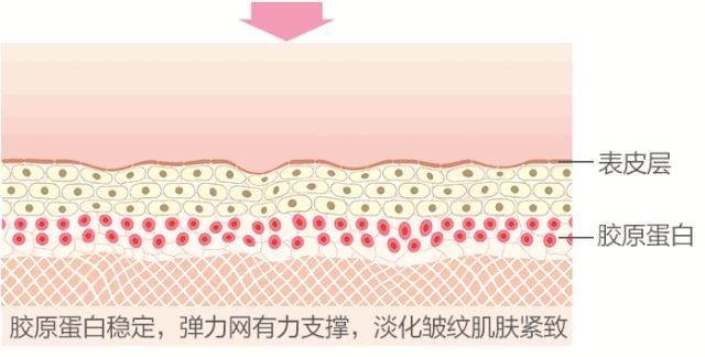 热玛吉处理脖子松弛效果怎么样,颈部皱纹很深热玛吉能去除吗