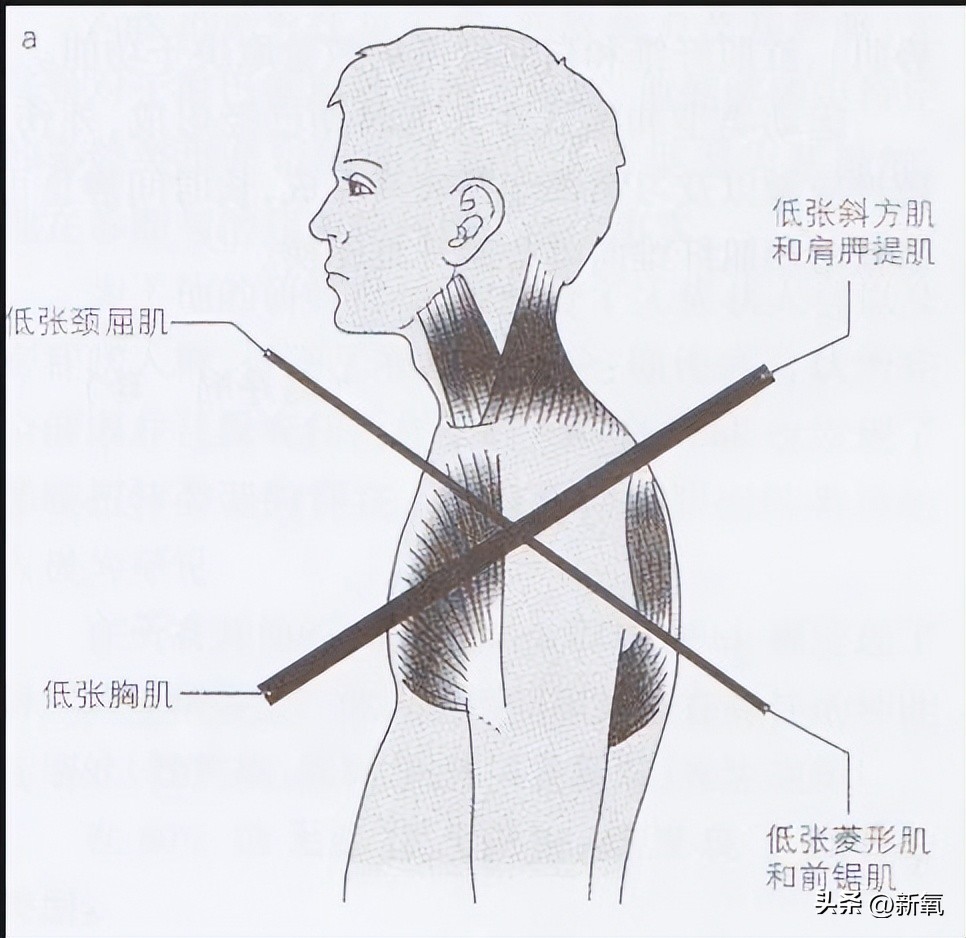 脸胖下垂是什么原因,脸肥下垂