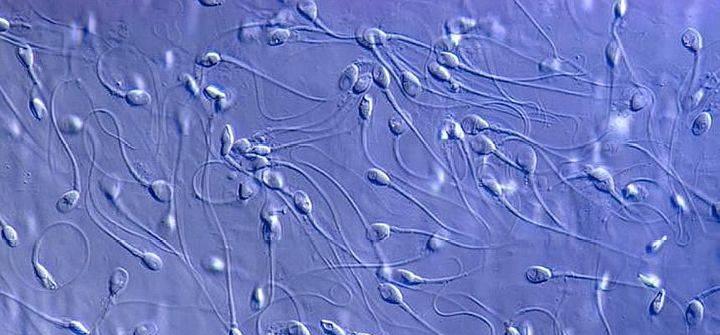 精子的运动能量,精子活动力半数呈直线运动