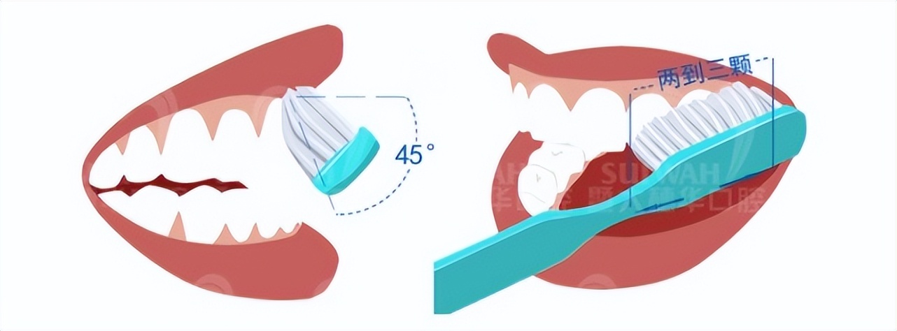 补牙后多久吃饭对牙修复更好,补牙后多久才能吃东西