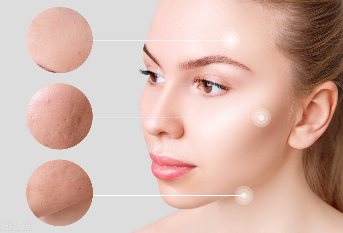 春季皮肤干燥脱皮是什么原因,冬季皮肤干燥起皮泛红刺痛怎么办