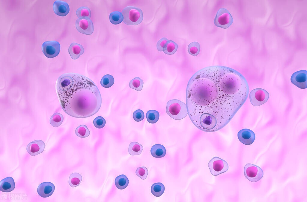 益脑平衡疗法治疗小脑萎缩,益脑补髓汤治疗小脑萎缩