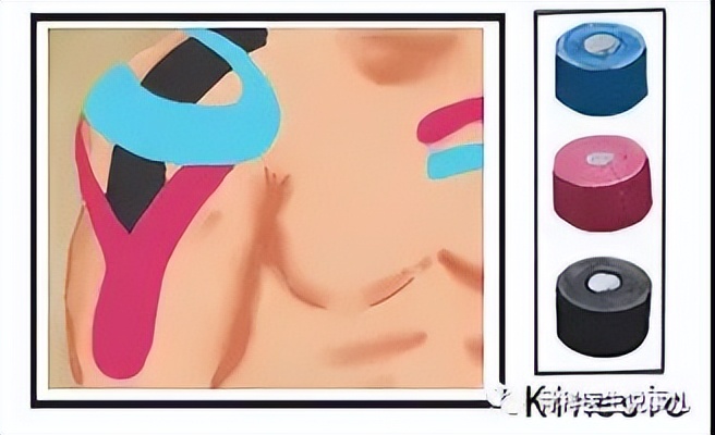 手臂抬举就酸胀是什么原因,手臂抬举肩膀就痛是什么原因