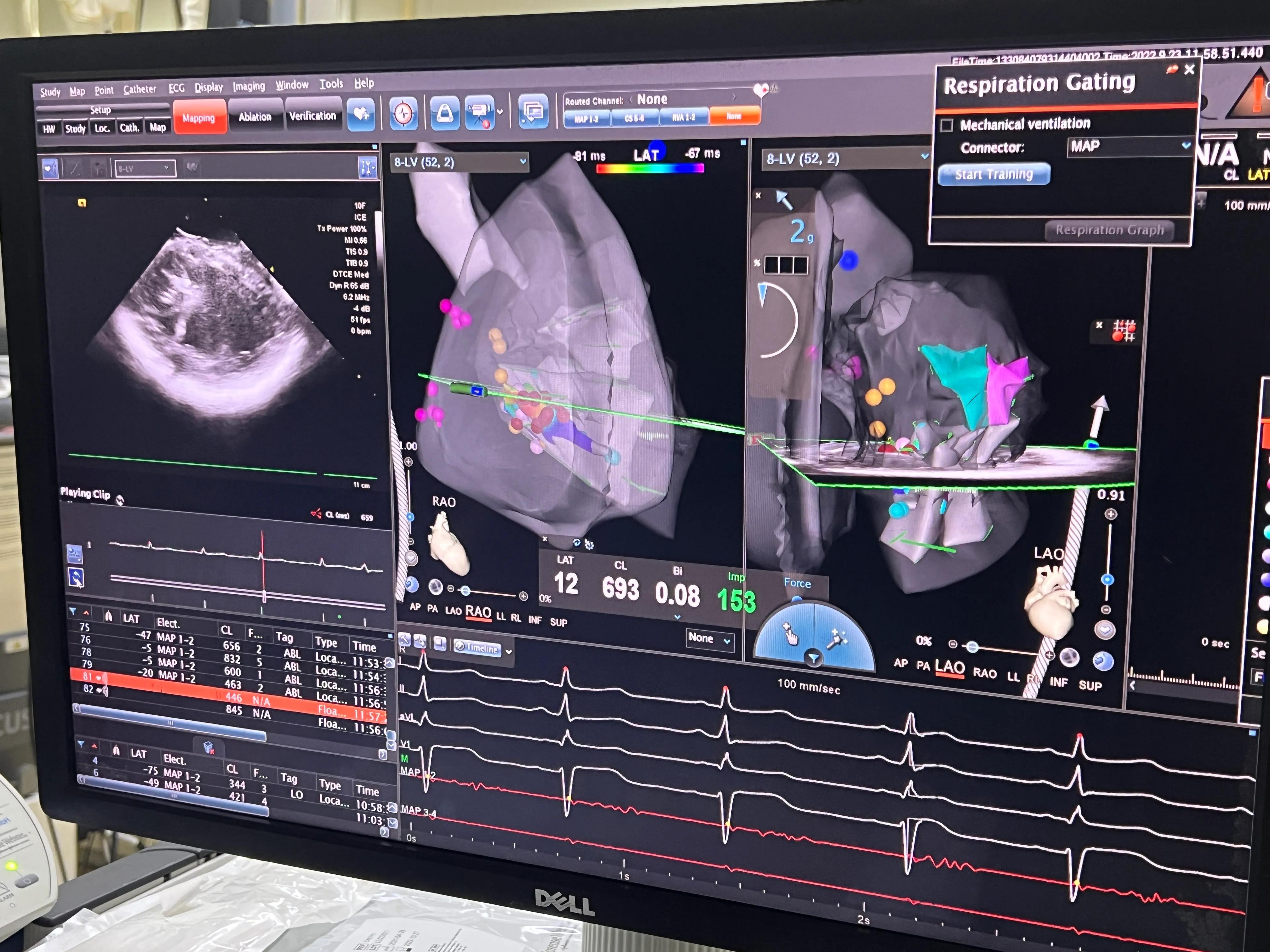 胸闷气促病例分析,小孩胸闷气短去检查说有炎症