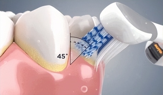 usmile电动牙刷和扉乐哪个好,飞利浦电动牙刷比usmile好在哪里