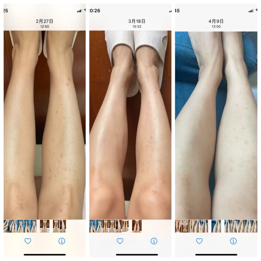 真实有效黑皮美白,针对天生黄黑皮美白一个月