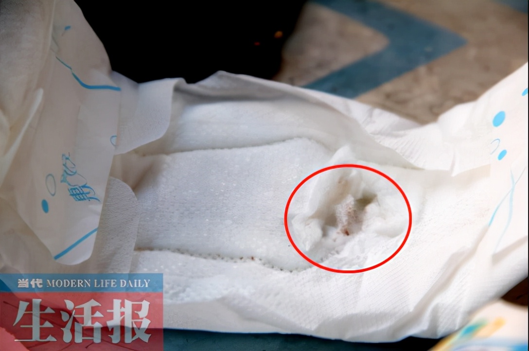 卫生巾内发现虫卵,卫生巾有细扁的小虫子