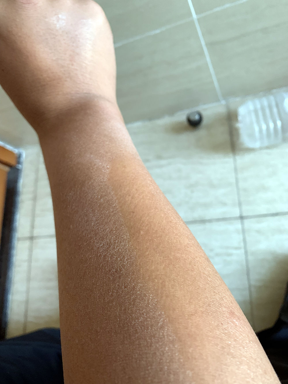 每到秋天，手和腿上就会出现各种干燥情况，还会脱皮，要怎么办？