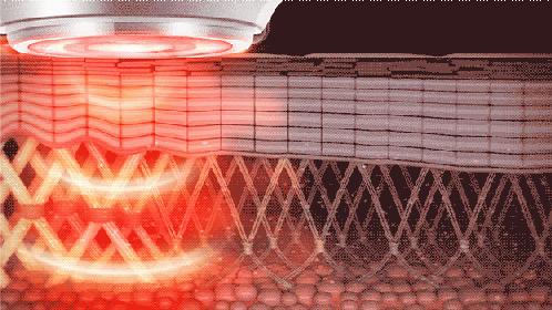 家用美容仪是黑科技还是忽悠你,家用美容仪真的有用吗