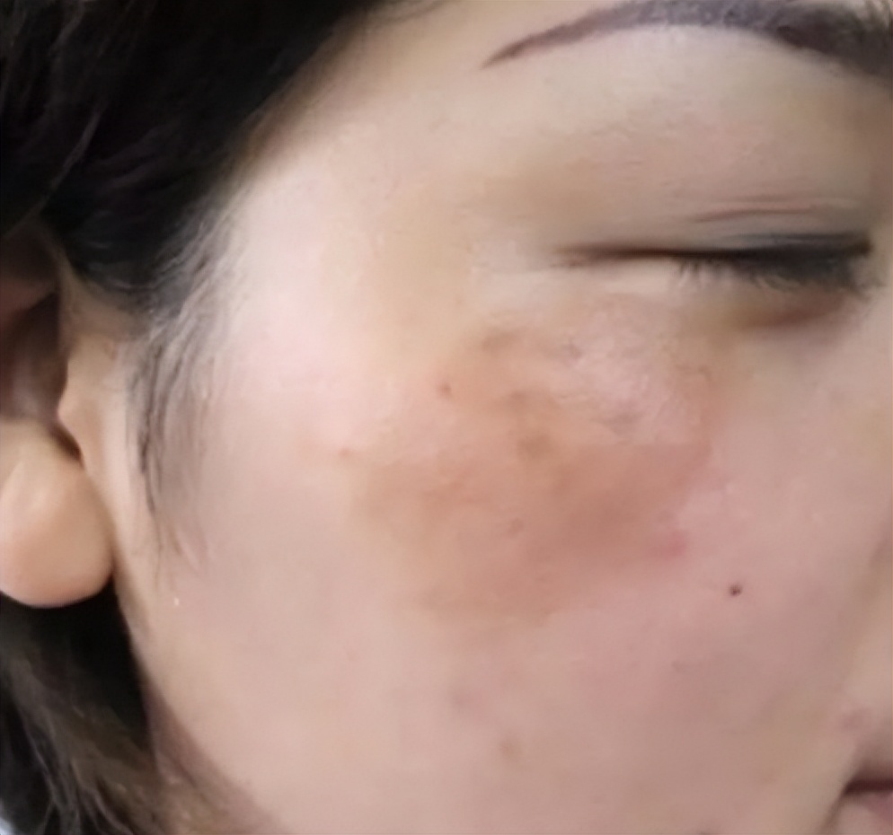 生姜和白醋放一起有啥妙用,把白醋和生姜放在一起有什么用