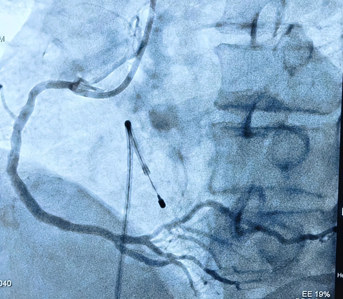 如何成为心内科医生,心内科医生养成记