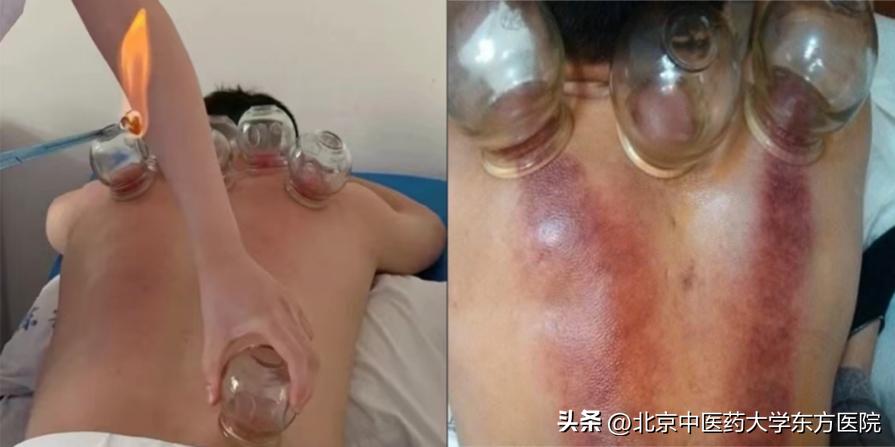 北京中医学院东方医院经开区咋样,北京中医药大学东方经开区院区