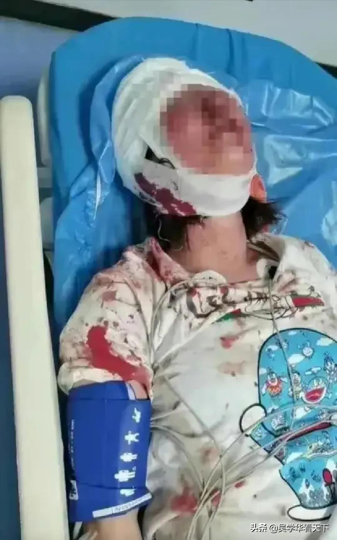 遇到唐山打人类似事件该怎么办,律师看待唐山打人事件